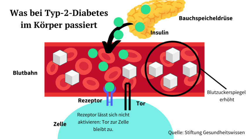 Insulin öffnet die Zelle nicht mehr richtig und der Zucker staut sich im Blut an.